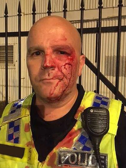 Police officer Nick Carter's bloody face after he was punched outside Monsoons nightclub on October 21, 2016