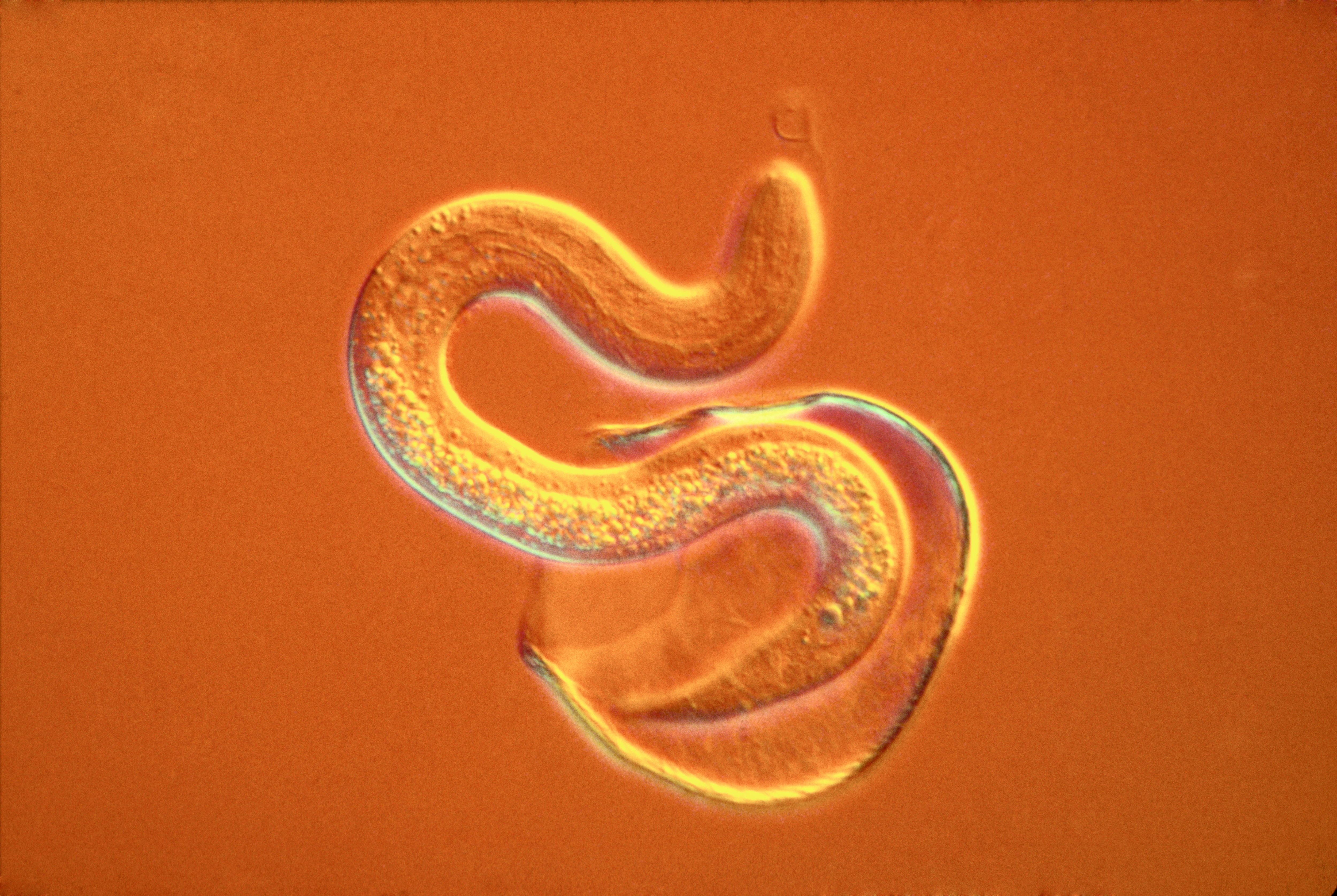 The wild and varied world of parasites - ABC listen