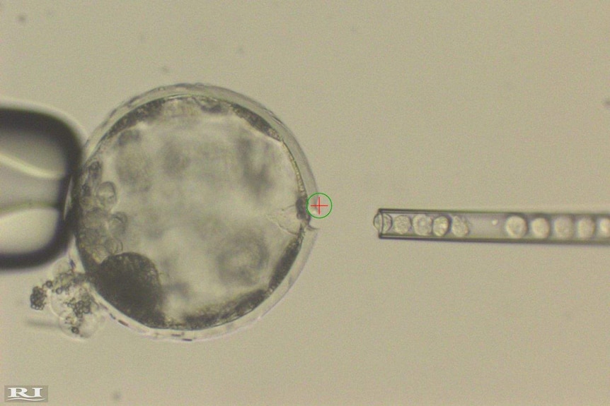 Injection of human iPS cells into a pig blastocyst