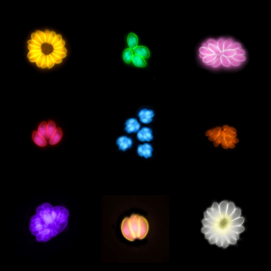 Colourful flower like shapes of the parasite Toxoplasma gondii