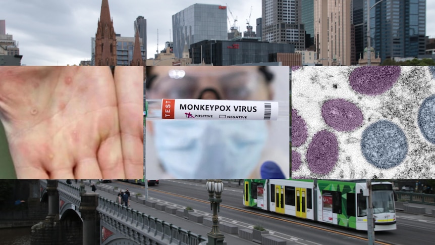 A composite image of monkeypox and the Melbourne CBD