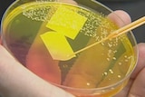 Scientists warn of golden staph epidemic
