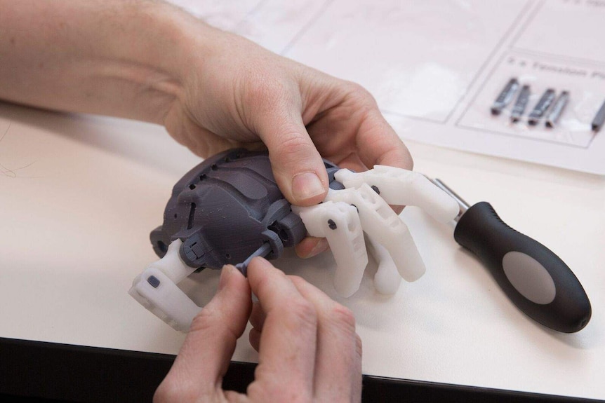 Assembling the prosthetic hand