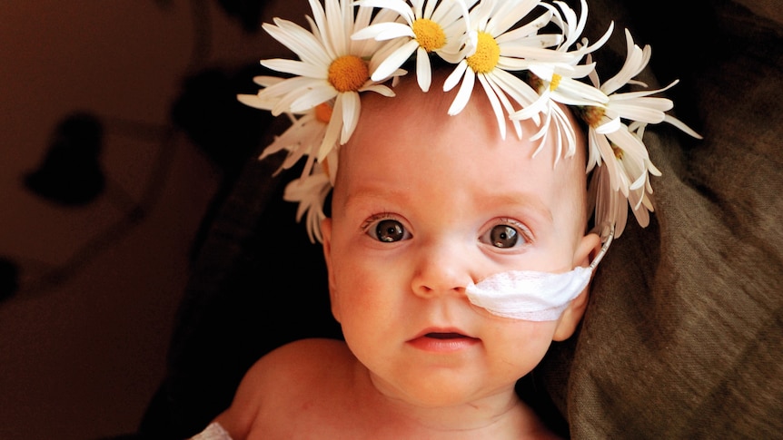 A baby with a tube coming from her nose and taped to her cheek. She is wearing a daisy chain on her head.
