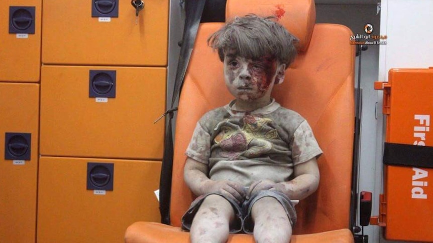 The iconic blood-stained face of five-year-old Omran Daqneesh after he was pulled from the rubble in Syria.