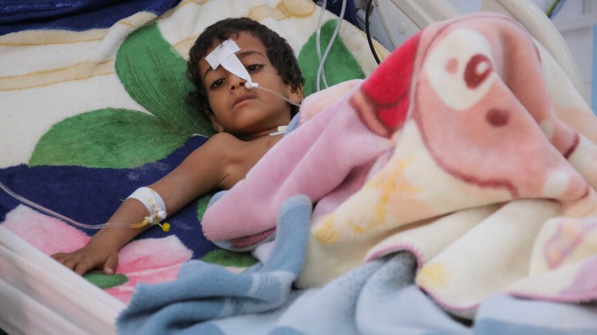 A child lays in a hospital bed with a tube in his nose.