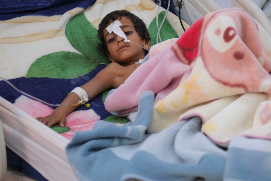 A child lays in a hospital bed with a tube in his nose.