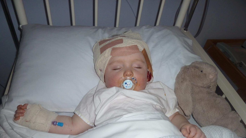 Baby William lying in a hospital bed to address complications caused by the virus CMV