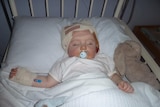 Baby William lying in a hospital bed to address complications caused by the virus CMV