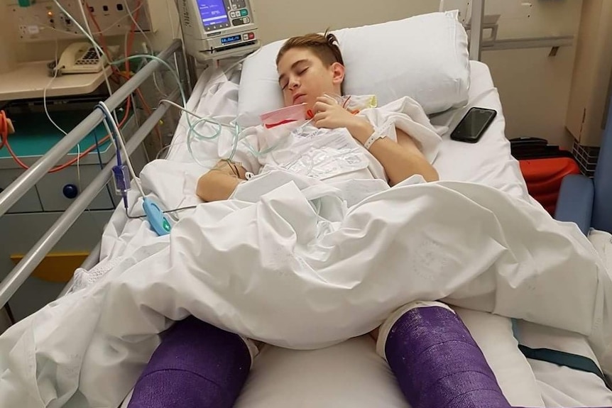 Boy on hospital bed with both legs in a purple cast