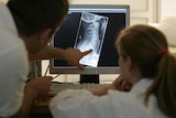 Doctors discuss medical treatment as they look at an X-ray image on a monitor.