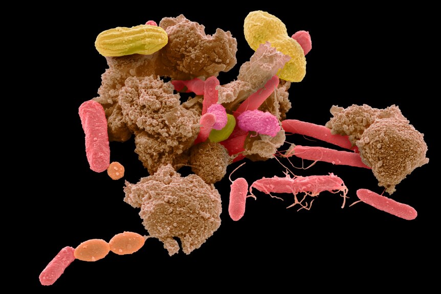 Magnified image of bacteria