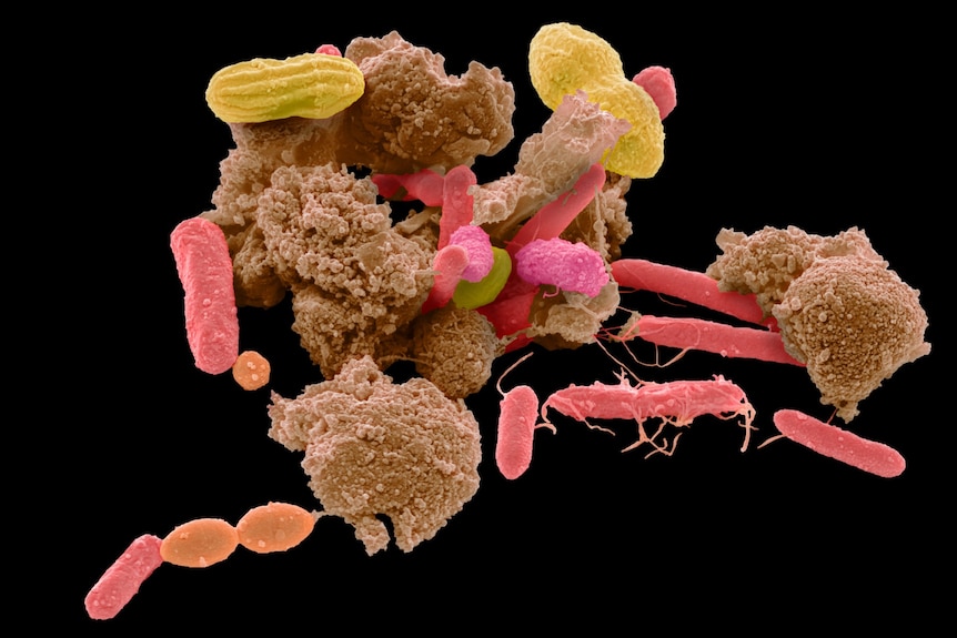 Magnified image of bacteria