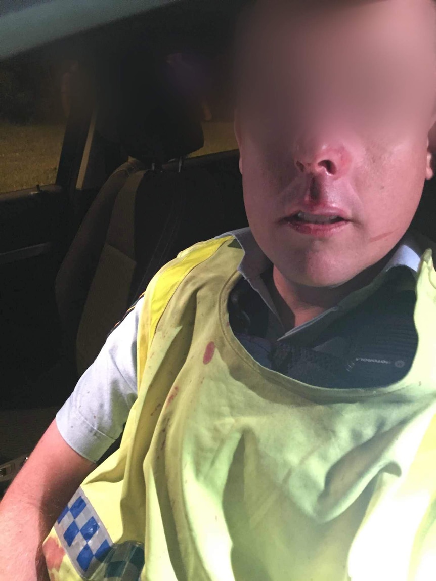 A policeman with a broken nose and some blood on his vest after he was attacked in Sydney's West.