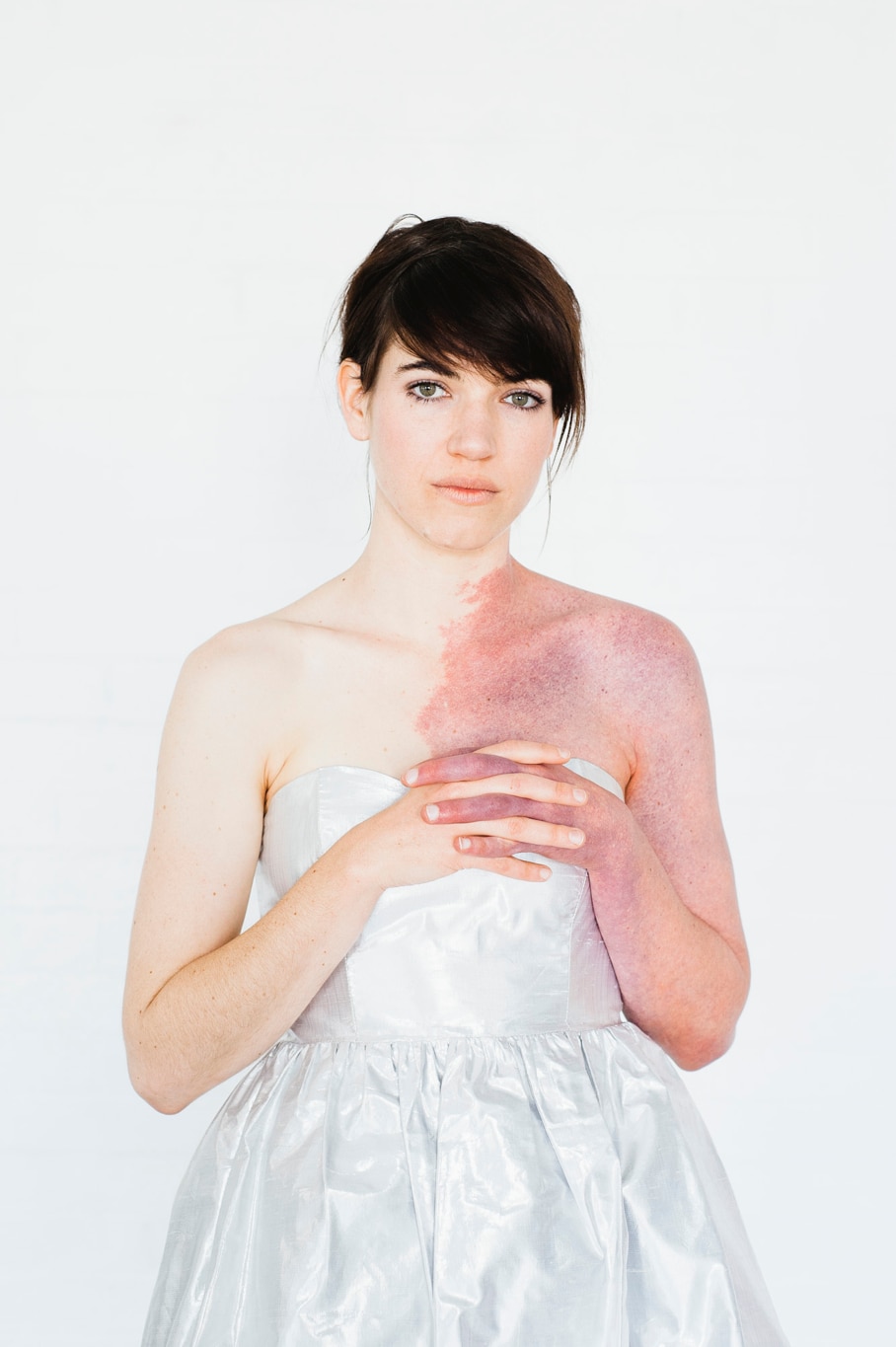 Nature's tattoos': beauty of birthmarks showcased in Sydney photography  exhibition - ABC News