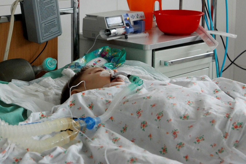 A young boy lies in a hospital bed, with medical machinery attached to his face.