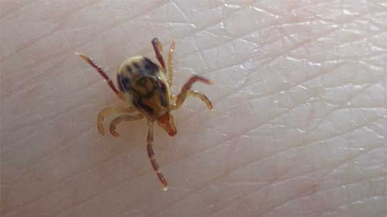 Tick removal: What's best way get them out? - News