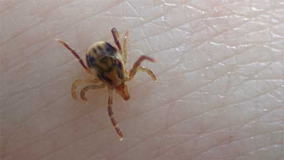 An Australian paralysis tick crawling across someone's skin.