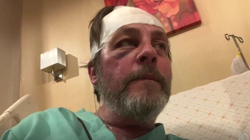 A man is seen in a hospital bed with his head bandaged. 