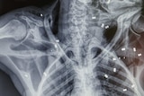 An x-ray of a orangutan's chest with several bullets lodges randomly throughout its torso.