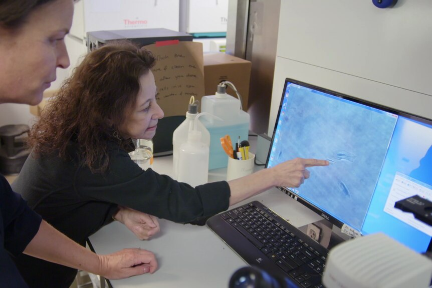 Professor Campisi points at an image of senescent cells on a computer monitor.
