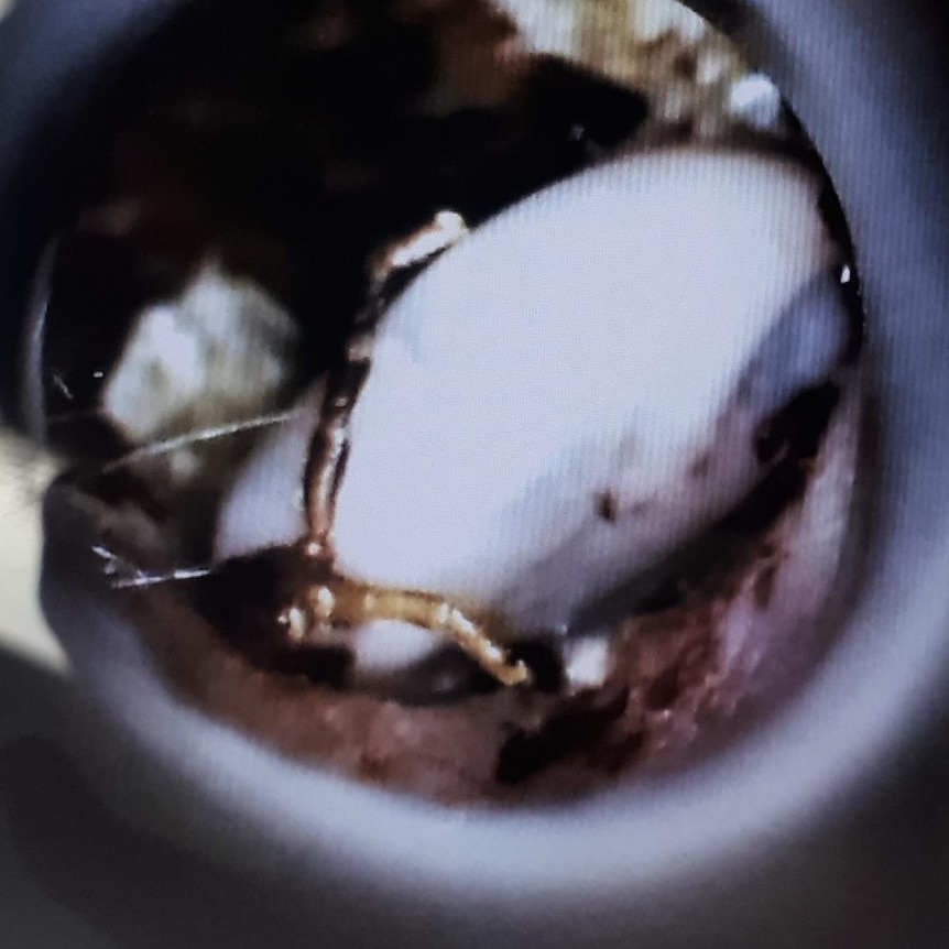 Paralysis tick lodged inside an ear canal.