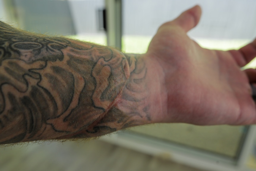 A close up of a man's tattooed forearm showing a large scar near the wrist.