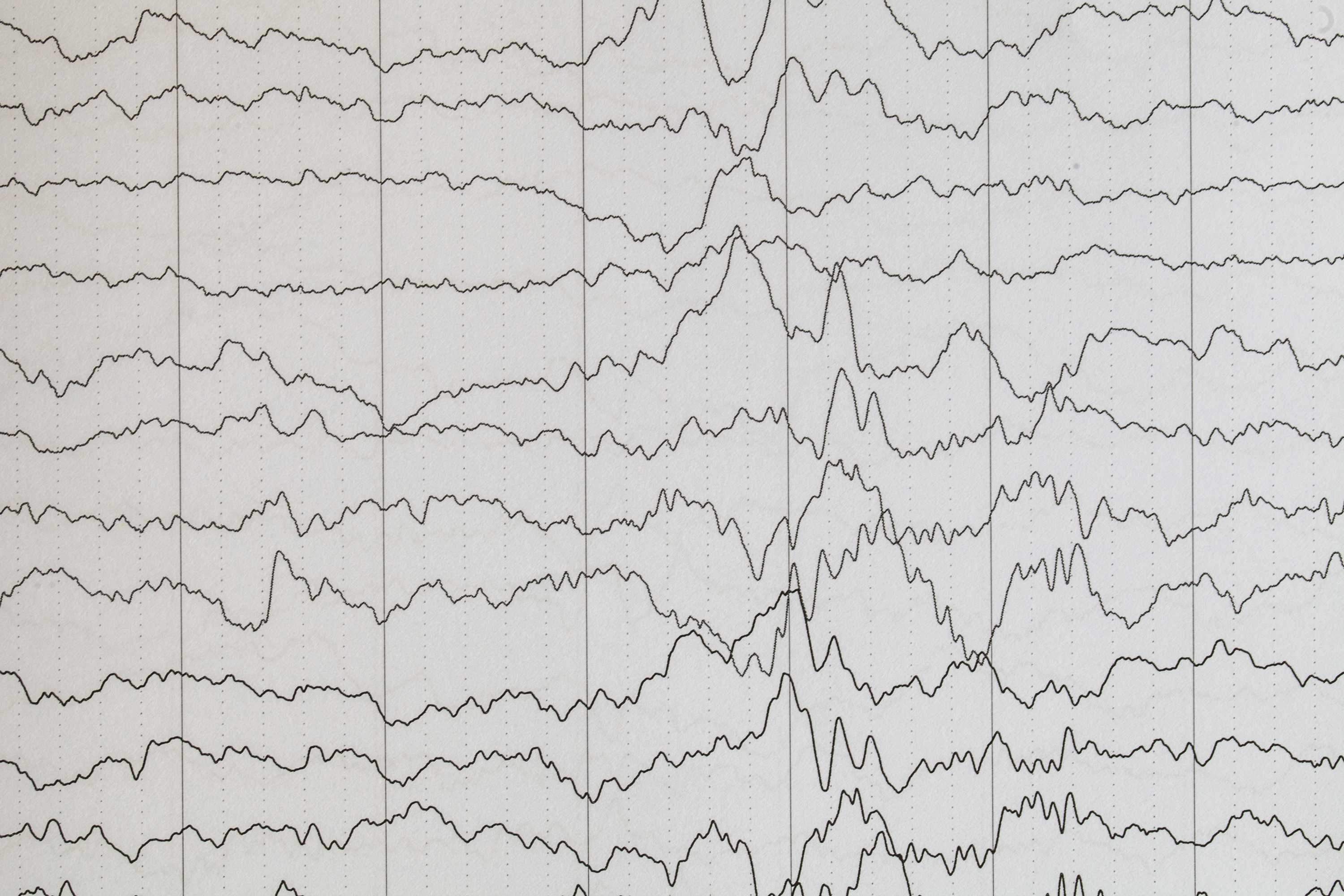 7.0 The sound of seizure