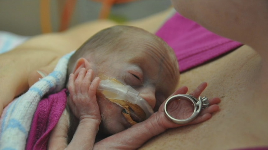 Madison Parsey was just 600 grams when she was born at 28 weeks