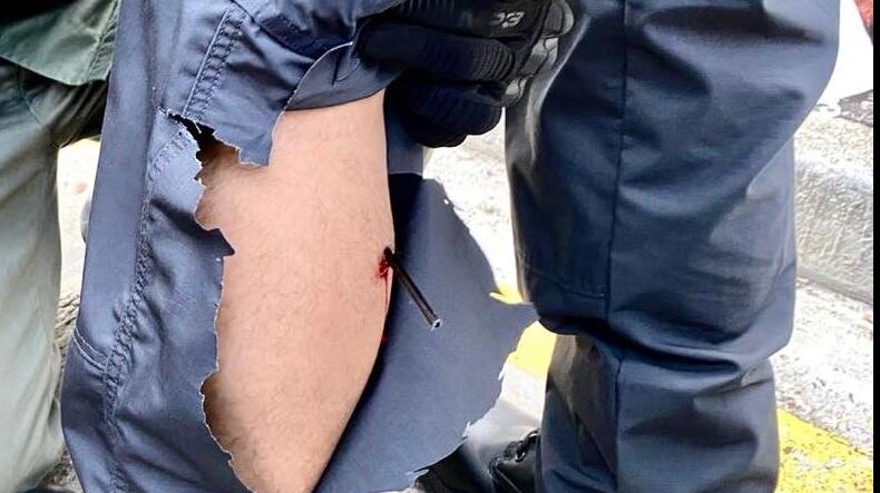 The arrow sticks in the police officer's calf muscle, drawing blood.