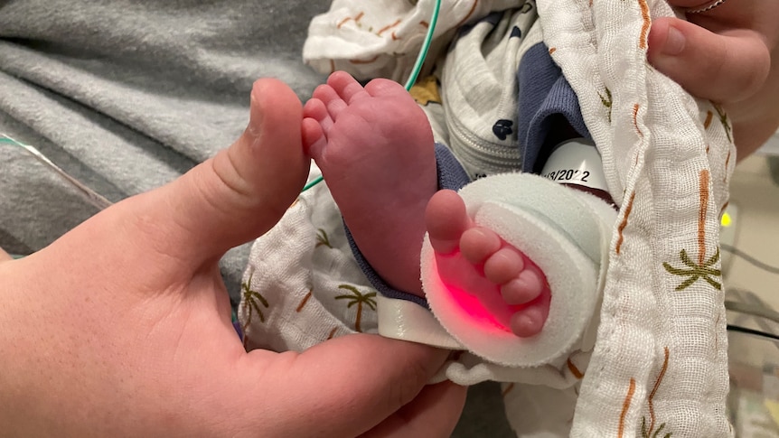 An infant's feet.