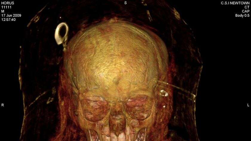 A CT scan of the skull of the ancient Egyptian mummy