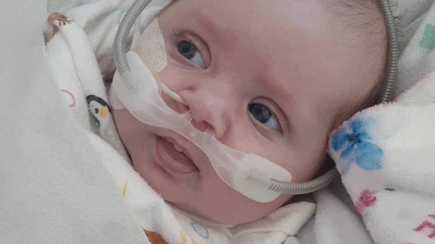 A close-up shot of baby Hazel in a hospital cot with her eyes open and tubes running from her nose.