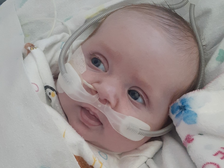 A close-up shot of baby Hazel in a hospital cot with her eyes open and tubes running from her nose.