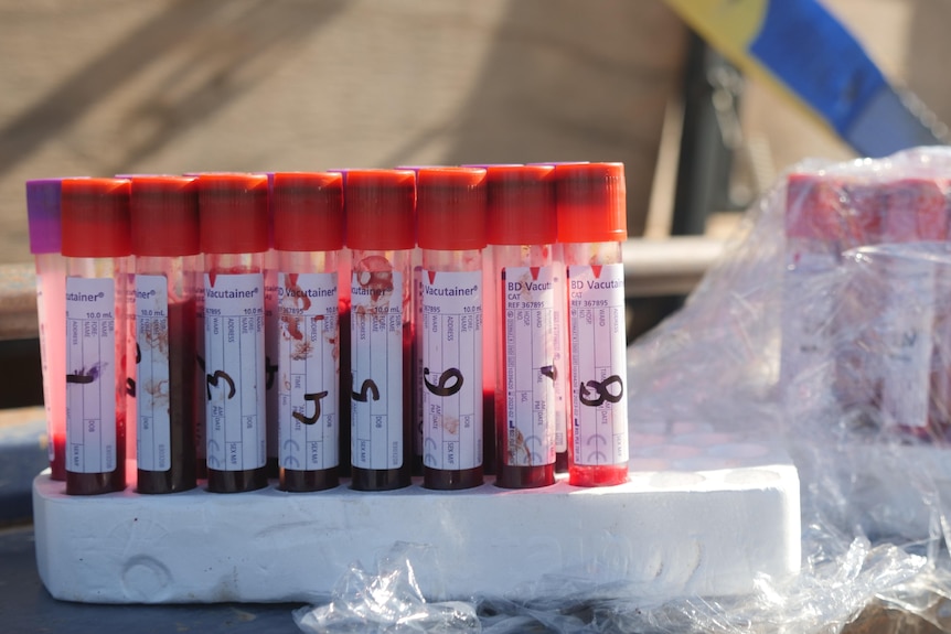A photo of multiple vials of sheep blood that is to be tested for Ovine Brucellosis