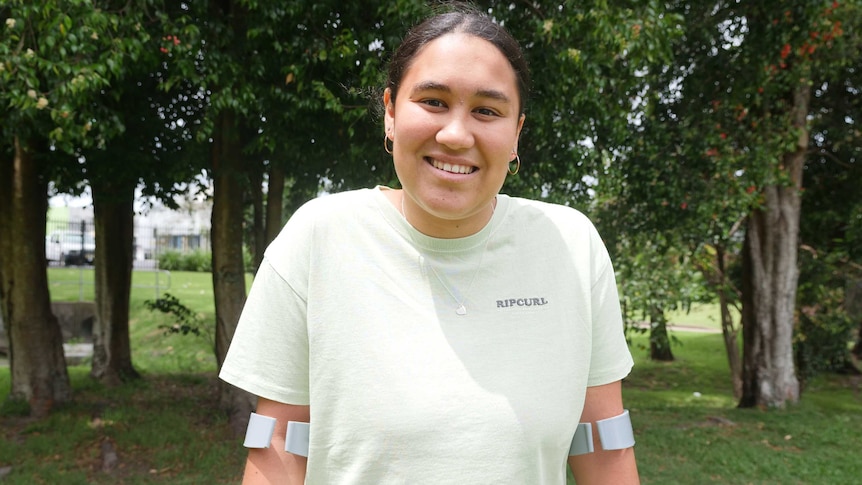 A young woman stands with crutches, smiling, in front of a tree.