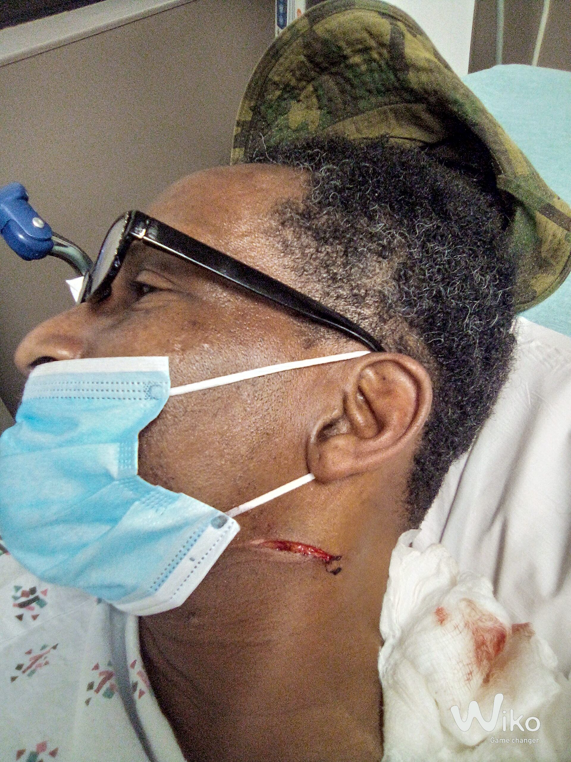 Kenneth's stab wound (1)