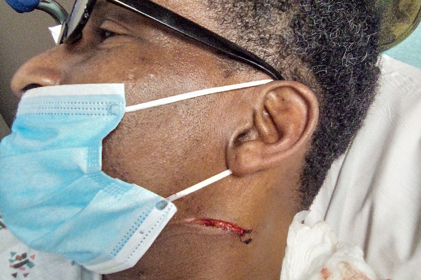 Kenneth's stab wound (1)