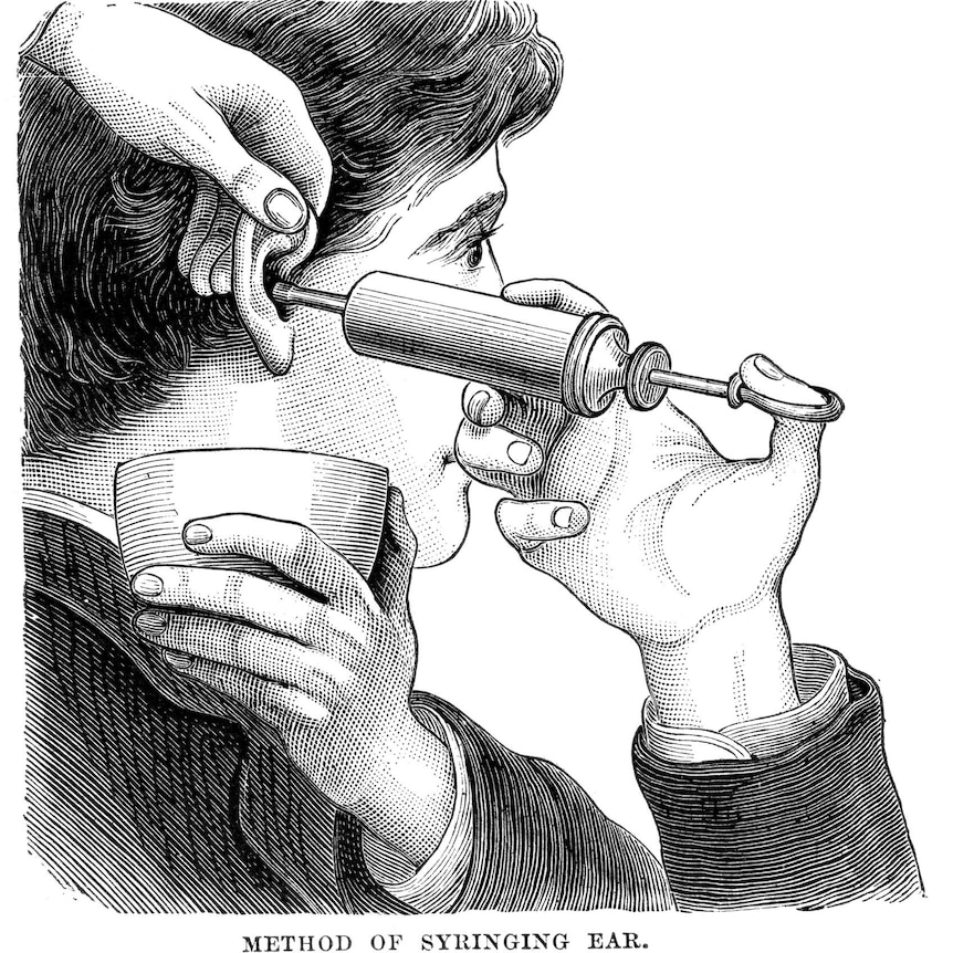 Vintage engraving of a Victorian doctor syringing a man's ear.