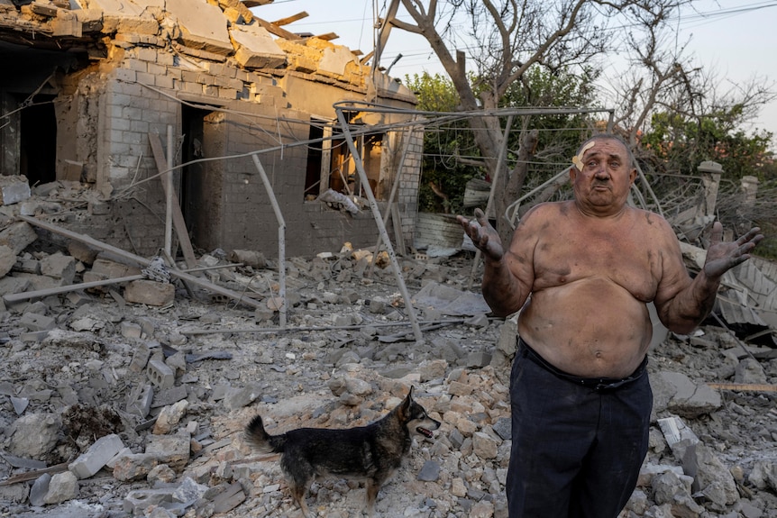 A bewildered looking shirtless man, covered in dust and with adhesive bandages on his head, stands in front of a pile of rubble.