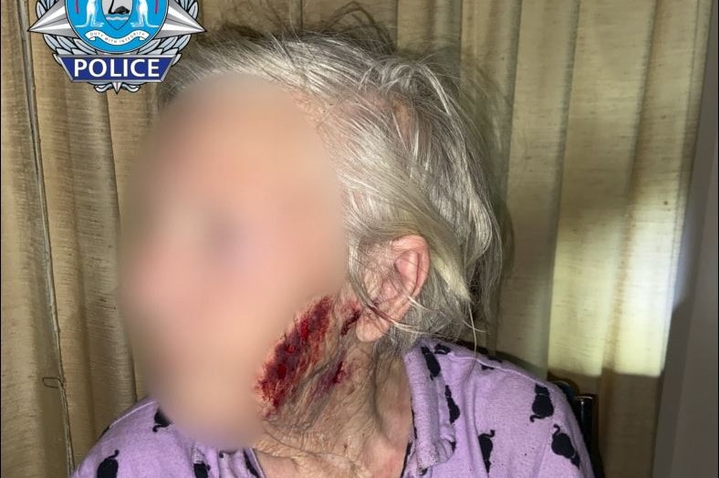 An elderly woman with her face blurred, with blood on her cheek.