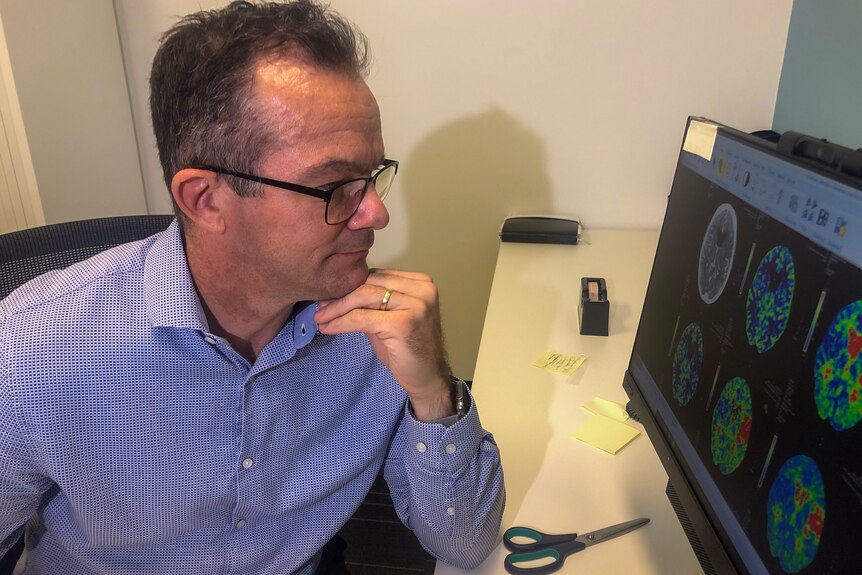 A doctor looks at brain scans on a computer 