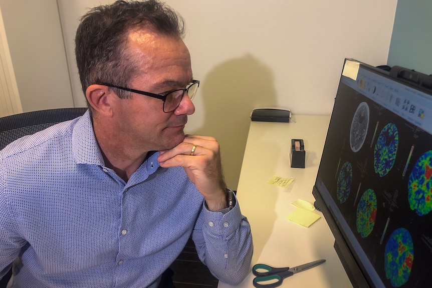 A doctor looks at brain scans on a computer 