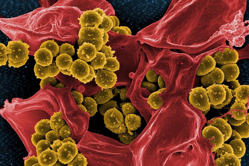 Bacteria through an electron microscope