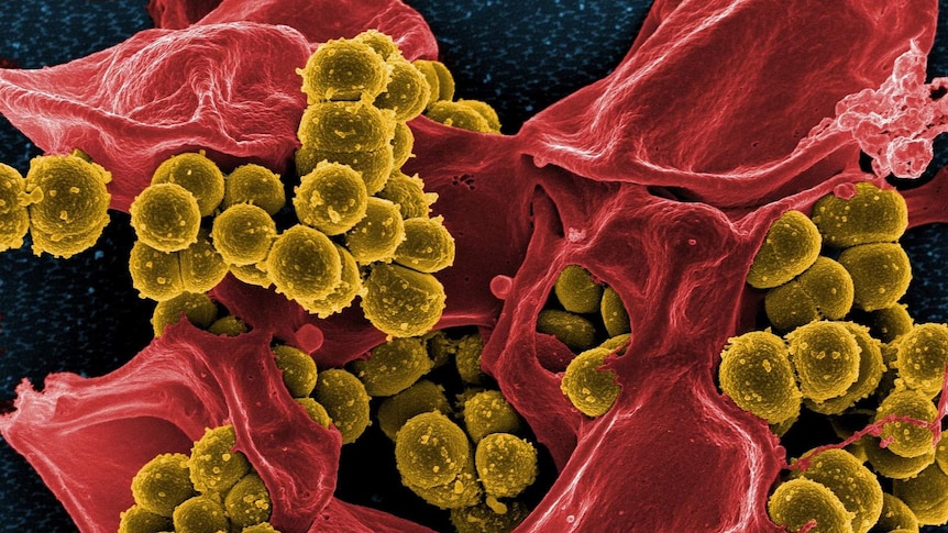 Bacteria through an electron microscope