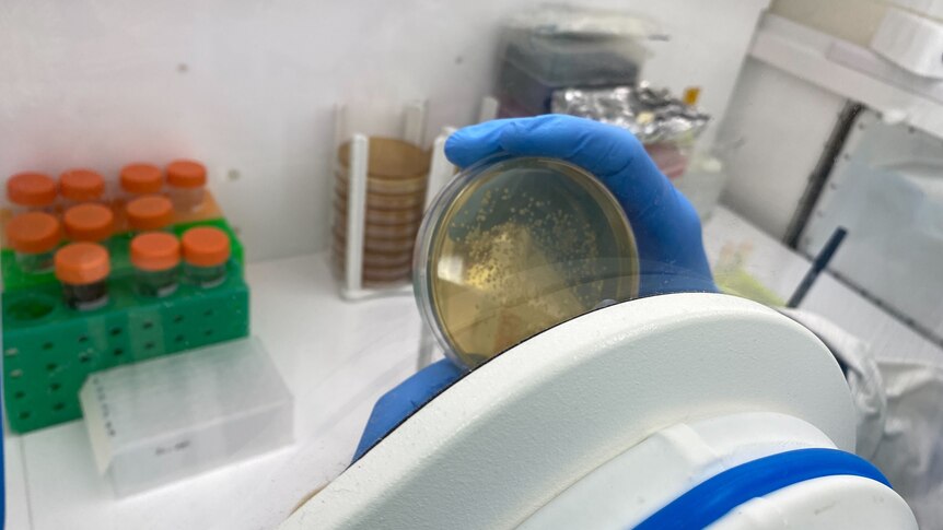 A hand holding a bacterial agar plate is inside a clear screen