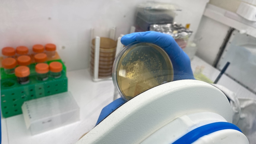 A hand holding a bacterial agar plate is inside a clear screen