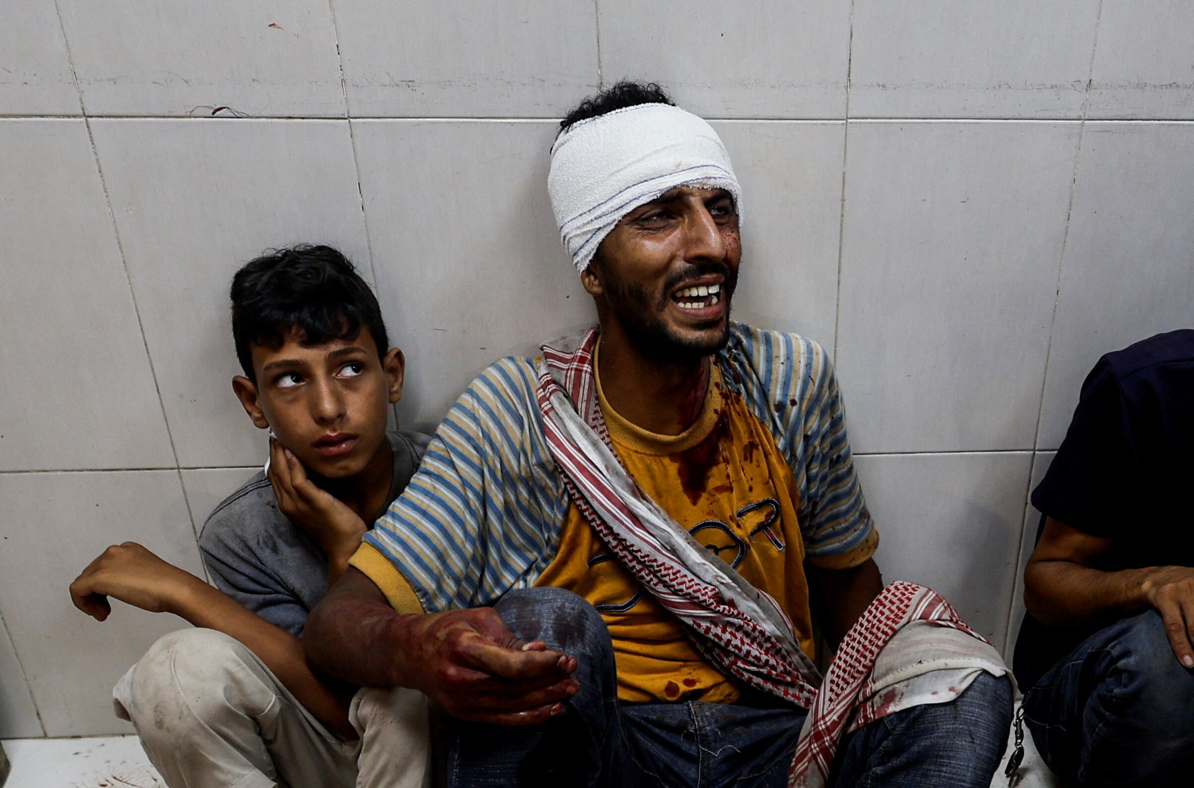 A man with his head bandaged and a pained expression sits on a hospital floor next to a young boy