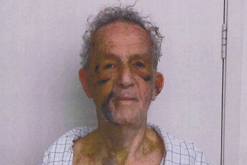 The 82-year-old man with heavy bruising around his eyes and mouth.