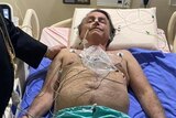 Jair Bolsonaro with no shirt lies on a hospital bed with various medical instruments attached to his body.